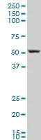 Western blot - Anti-ARHGAP1 antibody (AB194425)