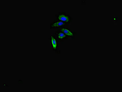 Immunocytochemistry/ Immunofluorescence - Anti-ARHGAP10 antibody (AB222805)