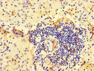 Immunohistochemistry (Formalin/PFA-fixed paraffin-embedded sections) - Anti-ARHGAP10 antibody (AB222805)