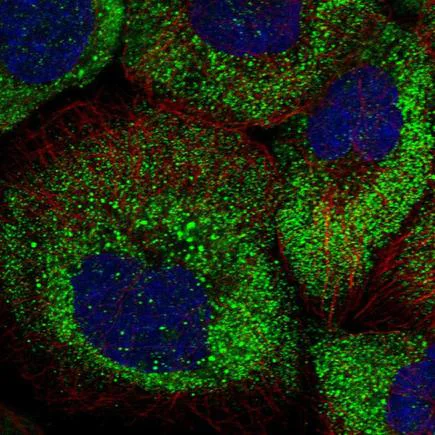 Immunocytochemistry/ Immunofluorescence - Anti-ARHGAP11A antibody (AB243713)
