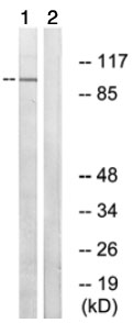 Western blot - Anti-ARHGAP17 antibody (AB74454)