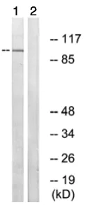 Western blot - Anti-ARHGAP17 antibody (AB74454)