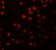 Immunocytochemistry/ Immunofluorescence - Anti-ARHGAP18 antibody (AB106553)