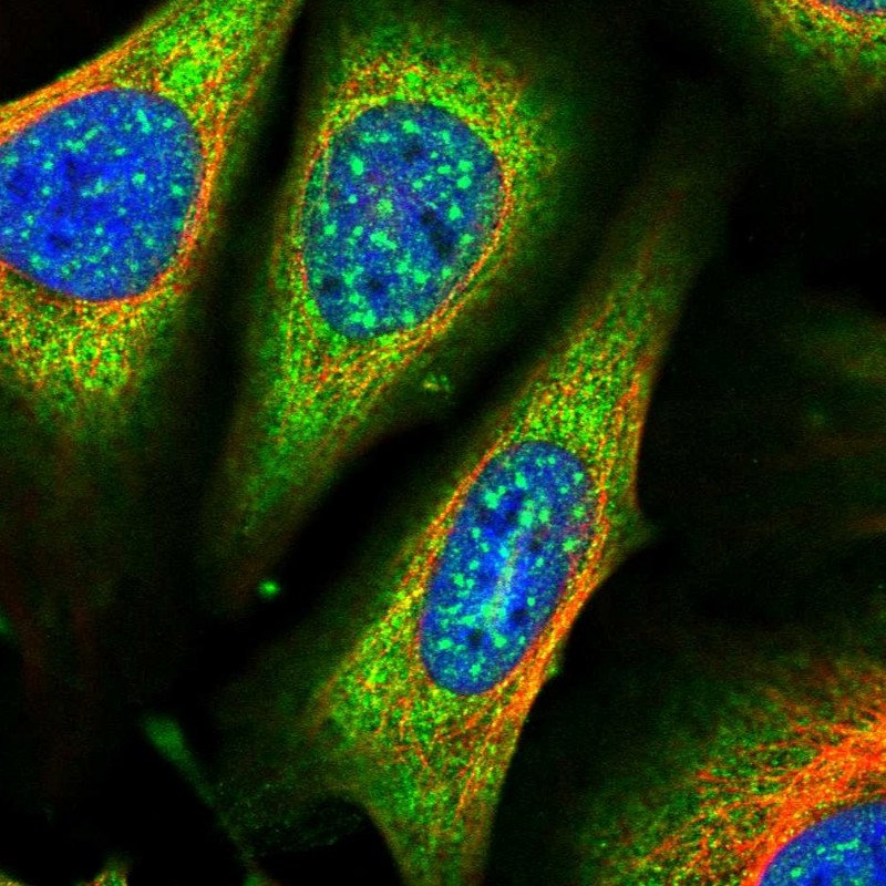 Immunocytochemistry/ Immunofluorescence - Anti-ARHGAP18 antibody (AB262926)