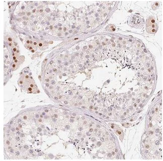 Immunohistochemistry (Formalin/PFA-fixed paraffin-embedded sections) - Anti-ARHGAP22 antibody (AB204743)