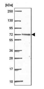 Western blot - Anti-ARHGAP22 antibody (AB204743)
