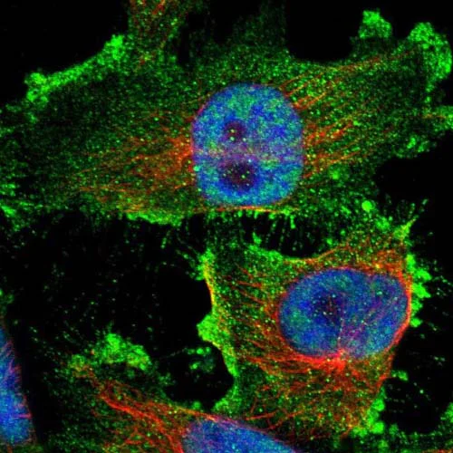 Immunocytochemistry/ Immunofluorescence - Anti-ARHGAP23 antibody (AB121617)