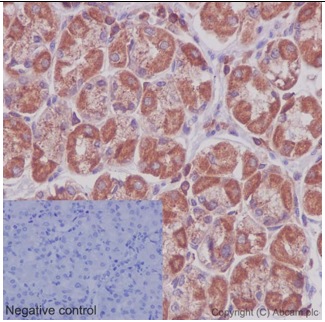 Immunohistochemistry (Formalin/PFA-fixed paraffin-embedded sections) - Anti-ARHGAP25 antibody [EPR13233-60] (AB192020)