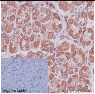 Immunohistochemistry (Formalin/PFA-fixed paraffin-embedded sections) - Anti-ARHGAP25 antibody [EPR13233-60] - BSA and Azide free (AB251103)