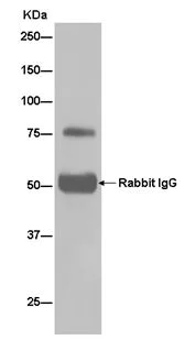 Immunoprecipitation - Anti-ARHGAP25 antibody [EPR13233] - BSA and Azide free (AB250423)