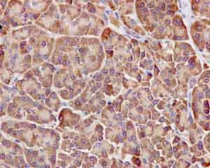 Immunohistochemistry (Formalin/PFA-fixed paraffin-embedded sections) - Anti-ARHGAP27 antibody [EPR12250] (AB171973)