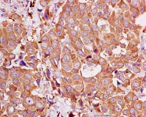 Immunohistochemistry (Formalin/PFA-fixed paraffin-embedded sections) - Anti-ARHGAP27 antibody [EPR12250] (AB171973)