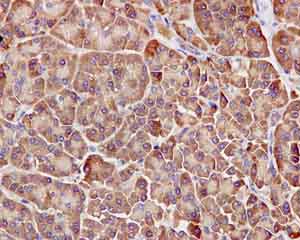 Immunohistochemistry (Formalin/PFA-fixed paraffin-embedded sections) - Anti-ARHGAP27 antibody [EPR12250] - BSA and Azide free (AB249685), expandable thumbnail