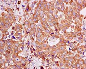 Immunohistochemistry (Formalin/PFA-fixed paraffin-embedded sections) - Anti-ARHGAP27 antibody [EPR12250] - BSA and Azide free (AB249685), expandable thumbnail