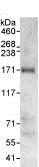 Immunoprecipitation - Anti-ARHGAP29 antibody (AB85853), expandable thumbnail