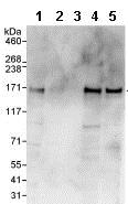 Western blot - Anti-ARHGAP29 antibody (AB85853), expandable thumbnail