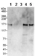Western blot - Anti-ARHGAP29 antibody (AB85853)