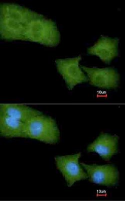 Immunocytochemistry/ Immunofluorescence - Anti-ARHGAP4 antibody (AB96251), expandable thumbnail