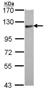 Western blot - Anti-ARHGAP4 antibody (AB96251)