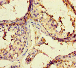 Immunohistochemistry (Formalin/PFA-fixed paraffin-embedded sections) - Anti-ARHGAP42 antibody (AB222815)