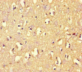 Immunohistochemistry (Formalin/PFA-fixed paraffin-embedded sections) - Anti-ARHGAP42 antibody (AB222815)