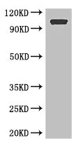 Western blot - Anti-ARHGAP42 antibody (AB222815)