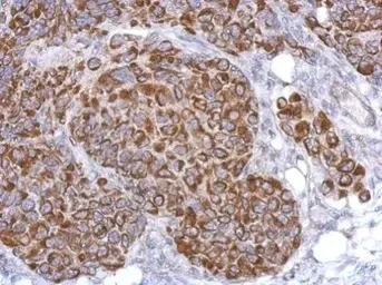 Immunohistochemistry (Formalin/PFA-fixed paraffin-embedded sections) - Anti-ARHGAP9 antibody (AB101361)