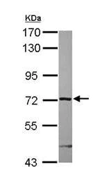Western blot - Anti-ARHGAP9 antibody (AB101361)