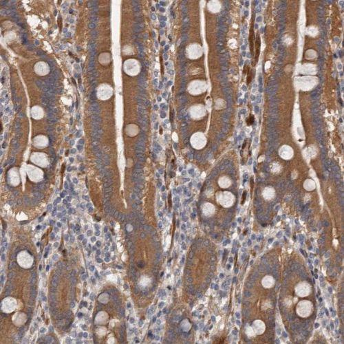 Immunohistochemistry (Formalin/PFA-fixed paraffin-embedded sections) - Anti-ARHGEF5 antibody (AB244433), expandable thumbnail