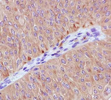 Immunohistochemistry (Formalin/PFA-fixed paraffin-embedded sections) - Anti-ARHGEF6 antibody [EPR11700(2)] (AB184569)