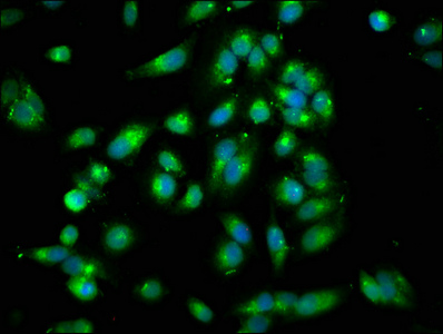 Immunocytochemistry/ Immunofluorescence - Anti-ARHGEF7 antibody (AB236103)