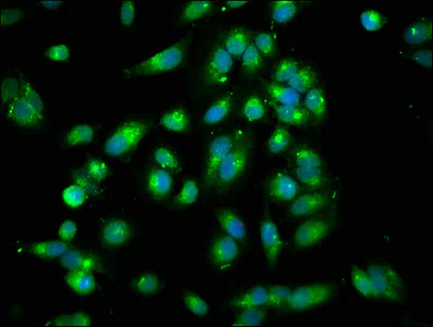 Immunocytochemistry/ Immunofluorescence - Anti-ARHGEF7 antibody (AB236103)