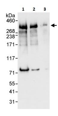 Western blot - Anti-ARID1A antibody (AB264171), expandable thumbnail