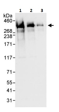 Western blot - Anti-ARID1A antibody (AB264172), expandable thumbnail