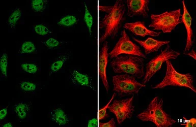 Immunocytochemistry/ Immunofluorescence - Anti-ARID1A antibody (AB272905)