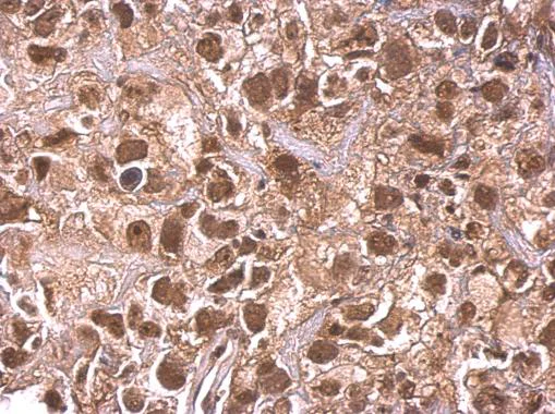 Immunohistochemistry (Formalin/PFA-fixed paraffin-embedded sections) - Anti-ARID1A antibody (AB272905)