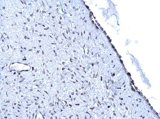 Immunohistochemistry (Formalin/PFA-fixed paraffin-embedded sections) - Anti-ARID1A antibody (AB272905)