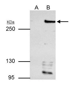Immunoprecipitation - Anti-ARID1A antibody (AB272905)