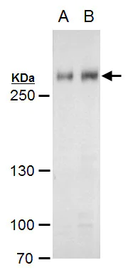 Western blot - Anti-ARID1A antibody (AB272905)