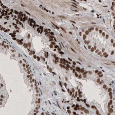 Immunohistochemistry (Formalin/PFA-fixed paraffin-embedded sections) - Anti-ARID1A antibody [CL3595] (AB242377)