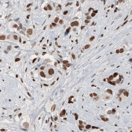 Immunohistochemistry (Formalin/PFA-fixed paraffin-embedded sections) - Anti-ARID1A antibody [CL3595] (AB242377)