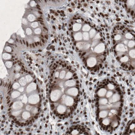 Immunohistochemistry (Formalin/PFA-fixed paraffin-embedded sections) - Anti-ARID1A antibody [CL3595] (AB242377)