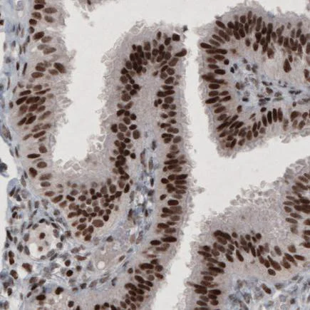 Immunohistochemistry (Formalin/PFA-fixed paraffin-embedded sections) - Anti-ARID1A antibody [CL3595] (AB242377)