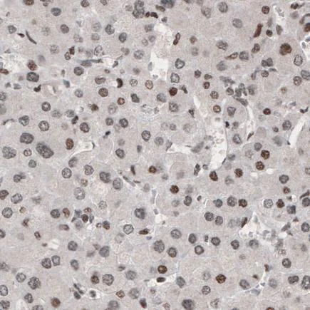 Immunohistochemistry (Formalin/PFA-fixed paraffin-embedded sections) - Anti-ARID1A antibody [CL3595] (AB242377)