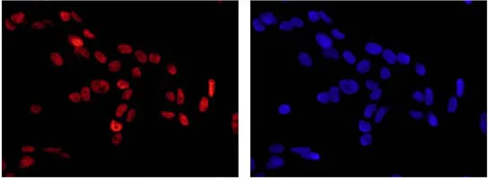 Immunocytochemistry/ Immunofluorescence - Anti-ARID1A antibody [EPR13501-73] (AB182561)
