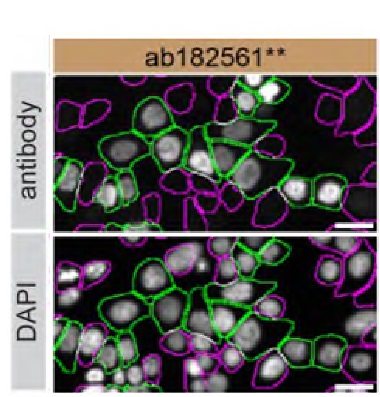 Immunocytochemistry/ Immunofluorescence - Anti-ARID1A antibody [EPR13501-73] (AB182561)