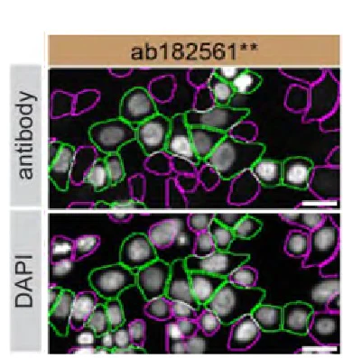 Immunocytochemistry/ Immunofluorescence - Anti-ARID1A antibody [EPR13501-73] (AB182561)