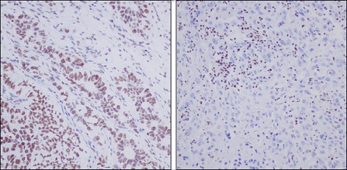 Immunohistochemistry (Formalin/PFA-fixed paraffin-embedded sections) - Anti-ARID1A antibody [EPR13501-73] (AB182561), expandable thumbnail