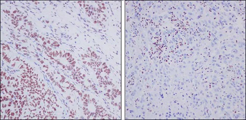 Immunohistochemistry (Formalin/PFA-fixed paraffin-embedded sections) - Anti-ARID1A antibody [EPR13501-73] (AB182561)