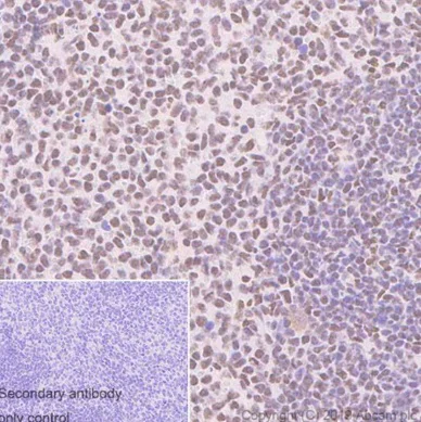 Immunohistochemistry (Formalin/PFA-fixed paraffin-embedded sections) - Anti-ARID1A antibody [EPR13501-73] (AB182561)